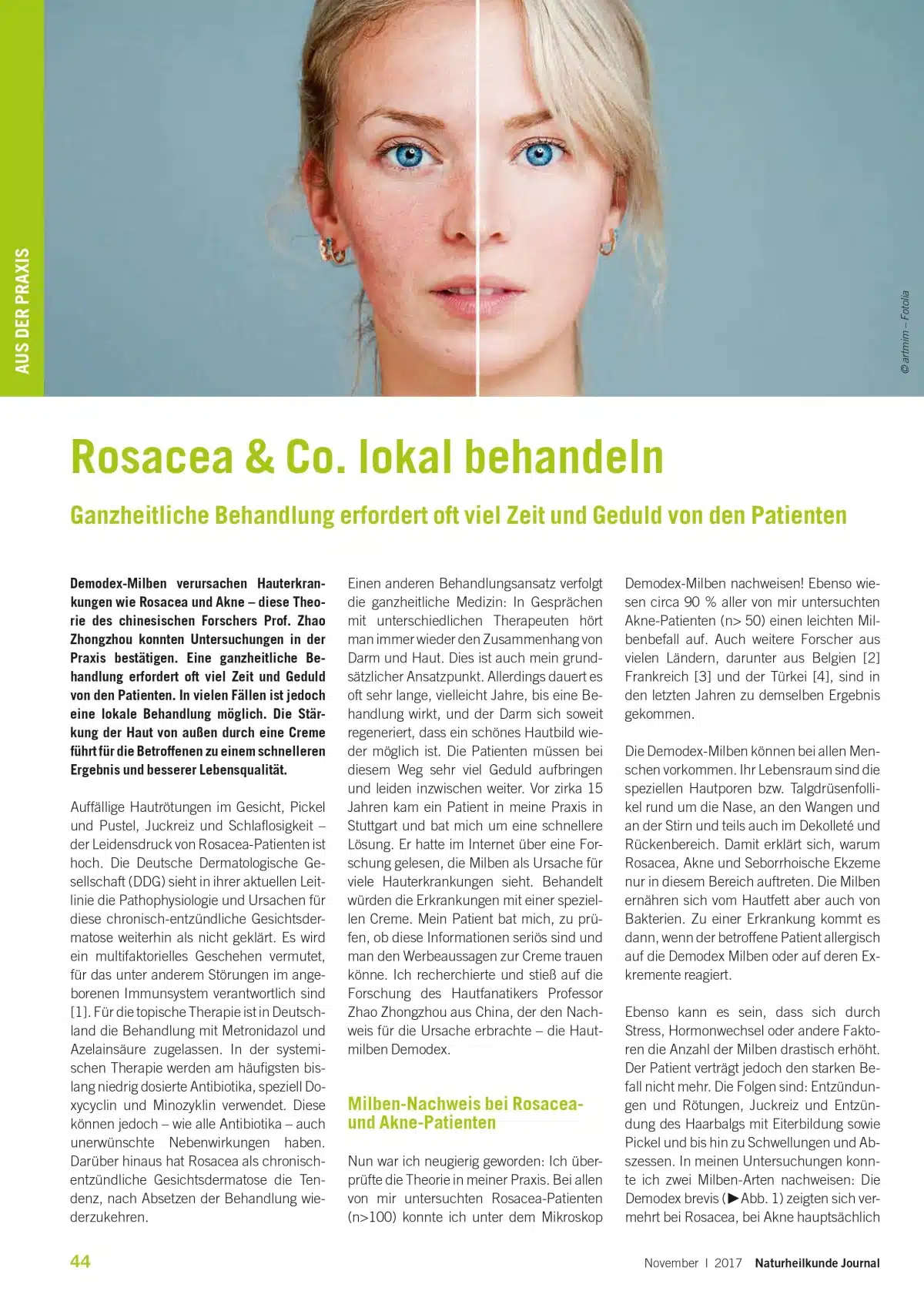 Rosacea & Co. lokal behandeln - Ein Artikel von Dominik Golenhofen im Naturheilkunde Journal