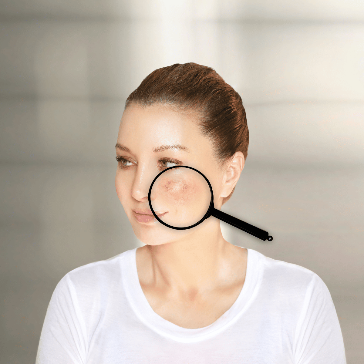 Dame mit Rosacea Dame mit Rosacea