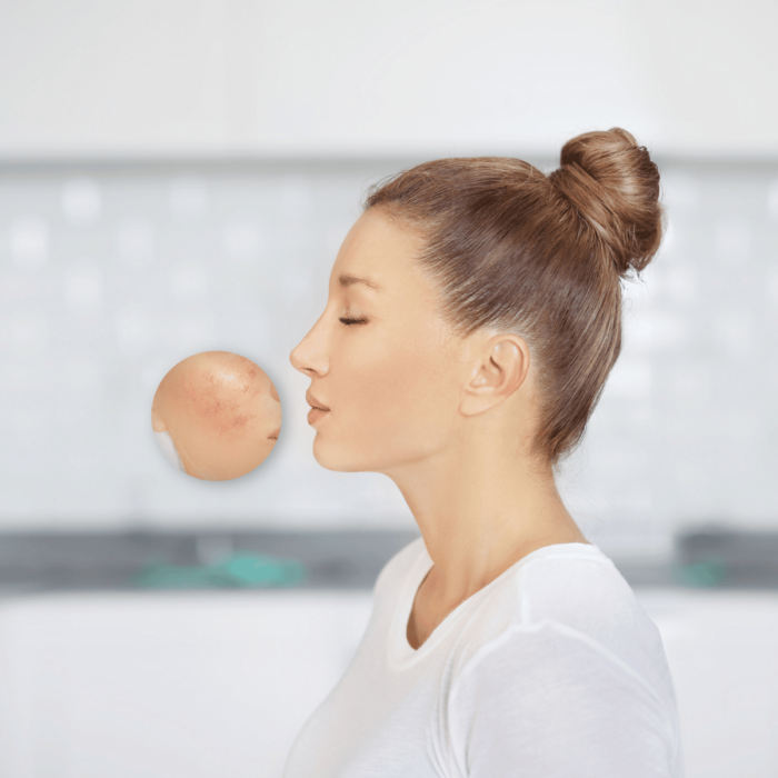 DemoDerm® - Hilf der Haut sich selbst zu helfen – mit einem ausgewogenem Hautmikrobiom DemoDerm - Hilf der Haut sich selbst zu helfen – mit einem ausgewogenem Hautmikrobiom