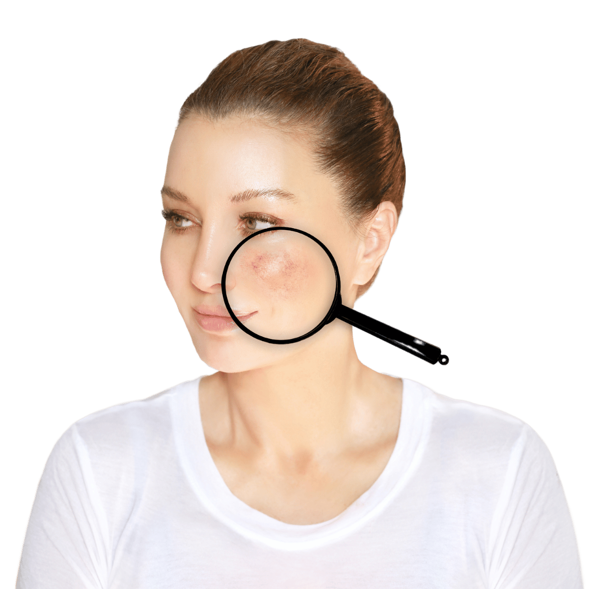 Rosacea - Definition, Ursachen & Auslöser, Hilfe Rosacea - Definition, Ursachen & Auslöser, Hilfe