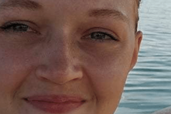 Rosacea geheilt: „Ich hatte viele kleine Pusteln auf der Stirn“ - DemoDerm Rosacea Blog