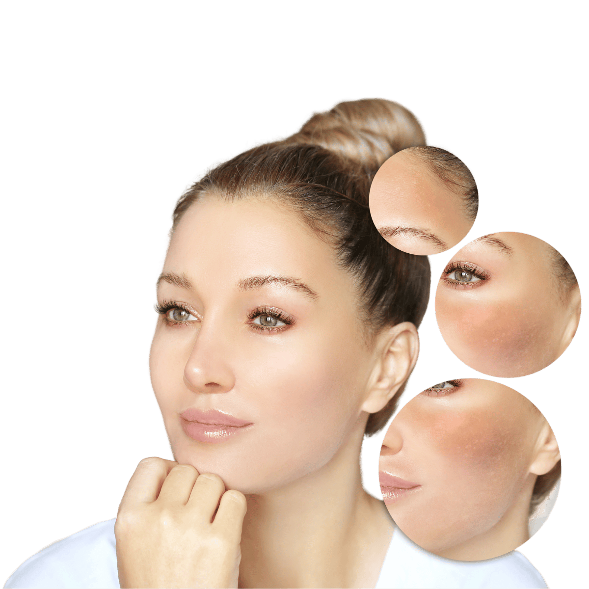 Rosacea Selbsthilfe in der DemoDerm® Facebook Gruppe DemoDerm®Anwender Rosacea Selbsthilfe in der DemoDerm Facebook Gruppe DemoDermAnwender