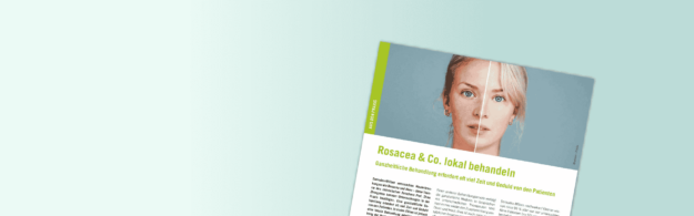 Rosacea & Co. lokal behandeln - DemoDerm Rosacea Blog