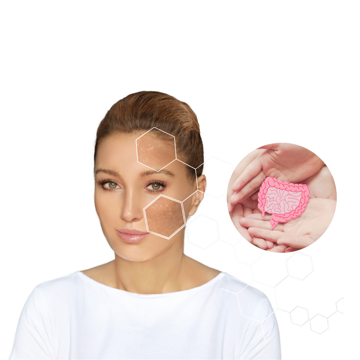 Zuhause auf SIBO testen - Dünndarmfehlbesiedlung bei Rosacea